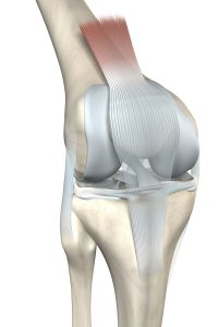 Spezielle Arthrose-Therapie